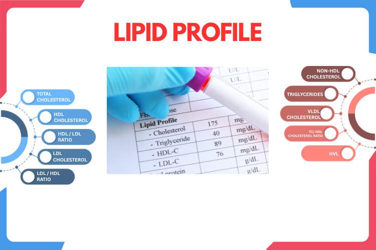 Lipid Profile