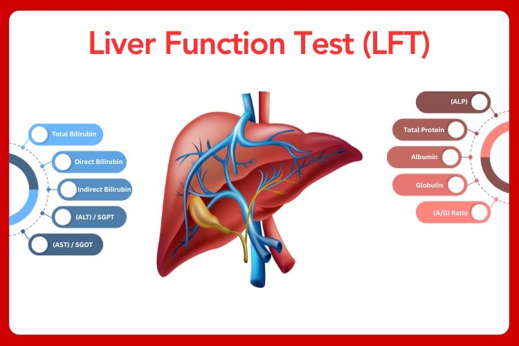 Liver Function Test (LFT)